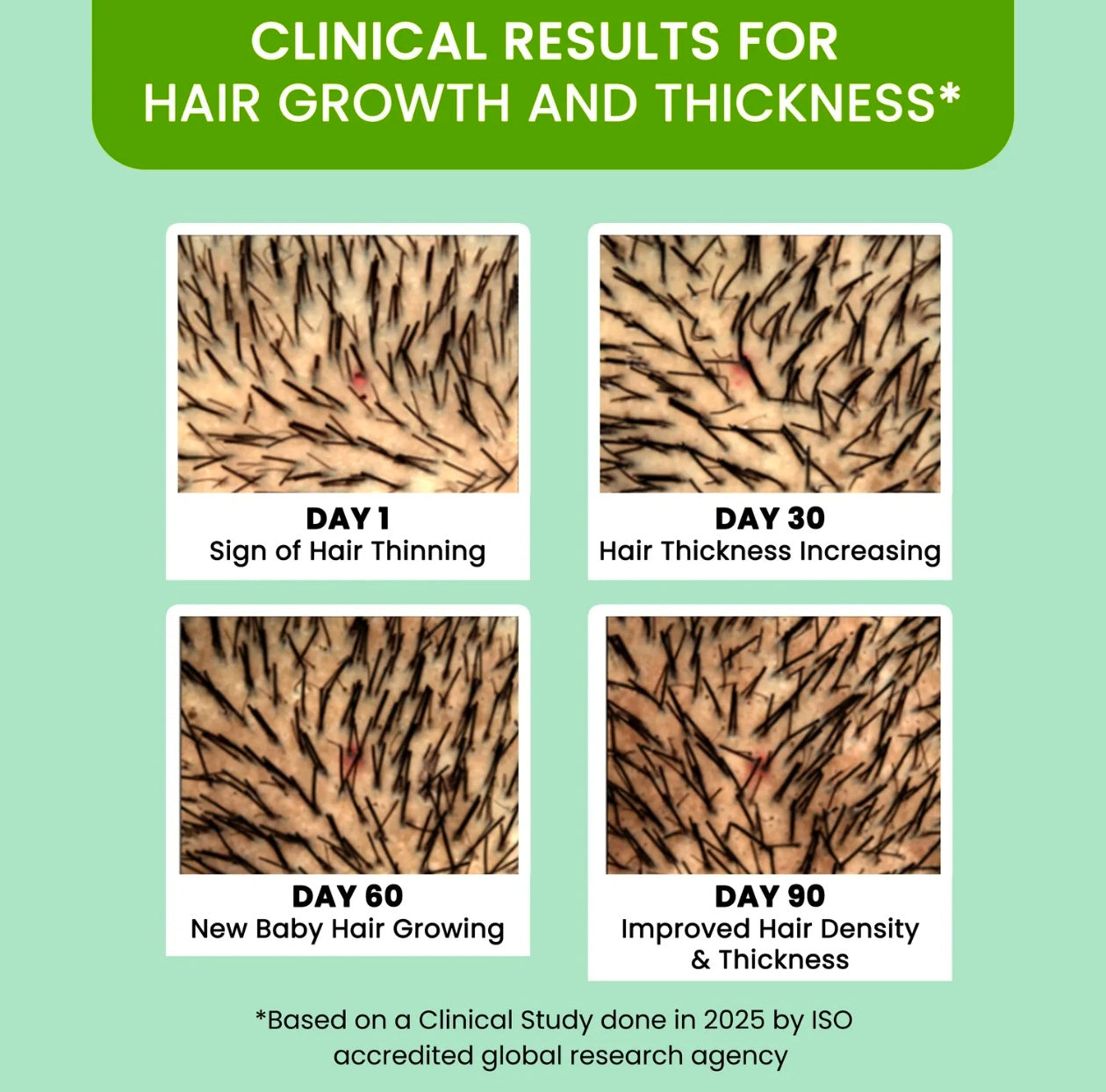 Alps Goodness Rosemary Water, Hair Spray For Regrowth & Strength